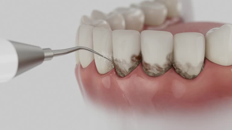 Trusted Dental Crowns And Bridges service in Lauderdale, MN - Dentist Open Now